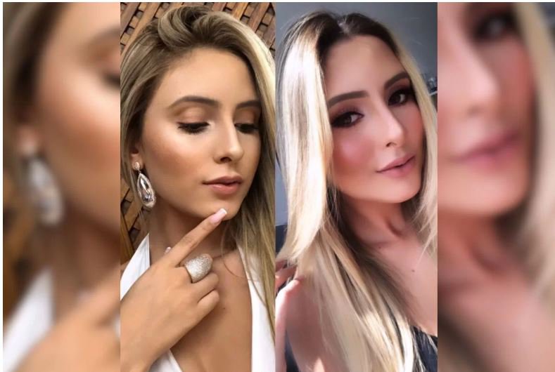 Não me reconhecia mais afirma influencer que fez quatro plásticas