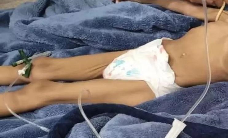 Menina de 3 anos resgatada após 40 dias sem comer tem alta de hospital