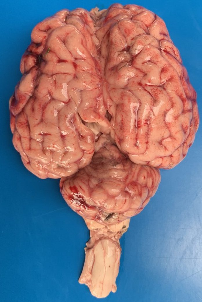 Jogos estimulam o cérebro: veja dicas de neurocientista - Saúde