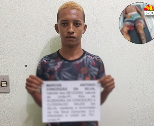 Homem é baleado em assentamento e morre em hospital no interior do Piauí