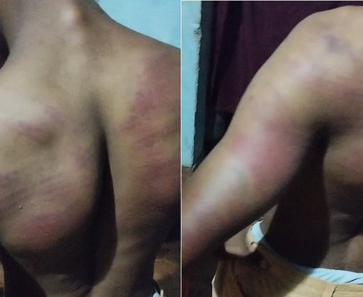Policiais são acusados de espancar jovem quilombola em município do Piauí
