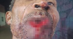 Fique por dentro: Adolescente é apreendido suspeito de morder homem na boca em Barro Duro