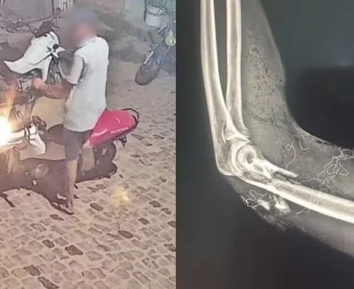 Entregador de pizza é baleado enquanto trabalhava em Barras, no Piauí