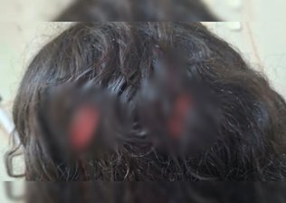 Menina de 12 anos é esfaqueada em sala de aula de escola particular
