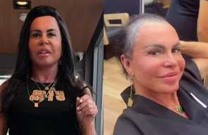 Gretchen surge sem prótese capilar e faz desabafo
