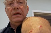 ataque de pitbull em SP