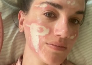 Esteticista de famosas perde licença após causar lesões em cliente