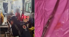Homem é esfaqueado durante cavalgada na zona rural de Luís Correia