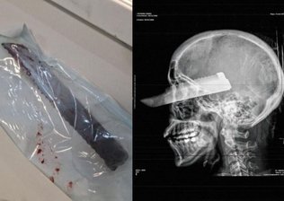 Homem que esfaqueou e cegou esposa é condenado a 35 anos de prisão no Oeste