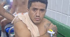 Homem sofre tentativa de homicídio a tiros e acaba preso ao dar entrada em hospital no Piauí