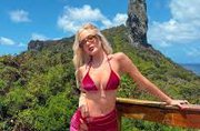 Karoline Lima mostra ferimentos nos pés durante cobertura da Copa