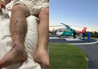 Homem leva duas picadas de cascavel e esgota o soro de hospital