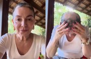 Mãe de Lucas Lucco desabafa sobre volta da alopecia: "Não é linear"