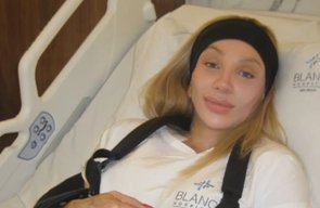 Maya Massafera faz cirurgia inédita no Brasil para diminuir largura das costas