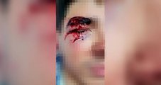 Morador de rua desfigura rosto de jovem com soco e é solto no mesmo dia em Águas Claras