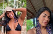 Marciele relata como quase ficou careca ao descobrir doença