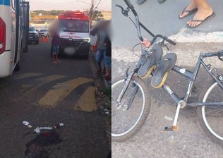 Criança tem pernas e braços esmagados após ser atropelada por ônibus enquanto andava de bicicleta