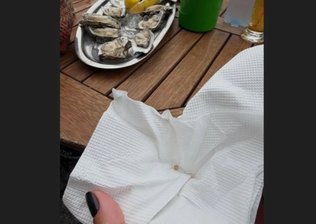 Mulher encontra pérola ao comer ostra exótica em Cananeia: "Tesouro do mar"